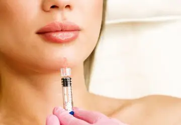 Closeup of syringe next to woman's lips about to inject lip fillers